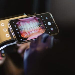 La photographie dentaire au quotidien : quel matériel, quel protocole, quelles indications ???